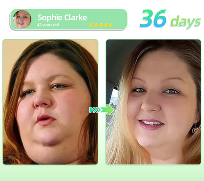 𝐕𝐢𝐬𝐢𝐛𝐥𝐞 𝐑𝐞𝐬𝐮𝐥𝐭𝐬 𝐢𝐧 𝟕 𝐃𝐚𝐲𝐬✅| PEAKA® 𝐆𝙇𝙋-𝟏 𝗘𝗳𝗳𝗲𝗿𝘃𝗲𝘀𝗰𝗲𝗻𝘁 𝗧𝗮𝗯𝗹𝗲𝘁𝘀- 🌿 𝑂𝑏𝑒𝑠𝑖𝑡𝑦 𝐶𝑎𝑟𝑑𝑖𝑜𝑣𝑎𝑠𝑐𝑢𝑙𝑎𝑟 𝐷𝑖𝑠𝑒𝑎𝑠 𝐷𝑖𝑎𝑏𝑒𝑡𝑒𝑠 𝑆𝑙𝑒𝑒𝑝 𝐴𝑝𝑛𝑒𝑎 𝐽𝑜𝑖𝑛𝑡 𝑃𝑟𝑜𝑏𝑙𝑒𝑚𝑠 𝑎𝑛𝑑 𝑀𝑜𝑟𝑒