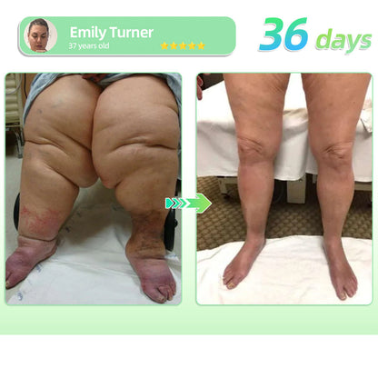 𝐕𝐢𝐬𝐢𝐛𝐥𝐞 𝐑𝐞𝐬𝐮𝐥𝐭𝐬 𝐢𝐧 𝟕 𝐃𝐚𝐲𝐬✅| PEAKA® 𝐆𝙇𝙋-𝟏 𝗘𝗳𝗳𝗲𝗿𝘃𝗲𝘀𝗰𝗲𝗻𝘁 𝗧𝗮𝗯𝗹𝗲𝘁𝘀- 🌿 𝑂𝑏𝑒𝑠𝑖𝑡𝑦 𝐶𝑎𝑟𝑑𝑖𝑜𝑣𝑎𝑠𝑐𝑢𝑙𝑎𝑟 𝐷𝑖𝑠𝑒𝑎𝑠 𝐷𝑖𝑎𝑏𝑒𝑡𝑒𝑠 𝑆𝑙𝑒𝑒𝑝 𝐴𝑝𝑛𝑒𝑎 𝐽𝑜𝑖𝑛𝑡 𝑃𝑟𝑜𝑏𝑙𝑒𝑚𝑠 𝑎𝑛𝑑 𝑀𝑜𝑟𝑒