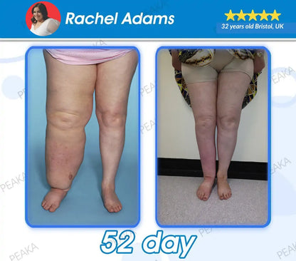 𝐎𝐟𝐟𝐢𝐜𝐢𝐚𝐥 𝐔𝐊 𝐒𝐭𝐨𝐫𝐞 | 𝐏𝐄𝐀𝐊𝐀® 𝐆𝐋𝐏-𝟏 𝐒𝐥𝐢𝐦𝐦𝐢𝐧𝐠 𝐋𝐢𝐪𝐮𝐢𝐝 𝐏𝐞𝐚𝐫𝐥𝐬– 𝐖𝐢𝐭𝐡 𝐍𝐀𝐃+, 𝐌𝐨𝐫𝐢𝐧𝐠𝐚, 𝐀𝐩𝐩𝐥𝐞 𝐂𝐢𝐝𝐞𝐫 𝐕𝐢𝐧𝐞𝐠𝐚𝐫 & 𝐊𝐞𝐭𝐨 𝐁𝐇𝐁 | 𝐅𝐚𝐬𝐭-𝐀𝐜𝐭𝐢𝐧𝐠, 𝐄𝐱𝐩𝐞𝐫𝐭-𝐃𝐞𝐯𝐞𝐥𝐨𝐩𝐞𝐝 𝐅𝐨𝐫𝐦𝐮𝐥𝐚 𝐟𝐨𝐫 𝐖𝐞𝐢𝐠𝐡𝐭 & 𝐇𝐞𝐚𝐥𝐭𝐡 𝐒𝐮𝐩𝐩𝐨𝐫𝐭