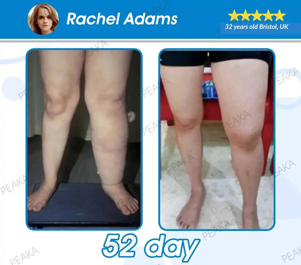 [𝐎𝐟𝐟𝐢𝐜𝐢𝐚𝐥 𝐔𝐊 𝐒𝐭𝐨𝐫𝐞] 𝐏𝐄𝐀𝐊𝐀® 𝐆𝐋𝐏-𝟏 𝐔𝐥𝐭𝐫𝐚 𝐂𝐨𝐧𝐜𝐞𝐧𝐭𝐫𝐚𝐭𝐞𝐝 𝐋𝐢𝐪𝐮𝐢𝐝 𝐏𝐞𝐚𝐫𝐥𝐬 – 𝐅𝐞𝐚𝐭𝐮𝐫𝐢𝐧𝐠 𝐍𝐀𝐃+, 𝐌𝐨𝐫𝐢𝐧𝐠𝐚, 𝐀𝐂𝐕 & 𝐊𝐞𝐭𝐨 𝐁𝐇𝐁( ✅ 𝐂𝐥𝐢𝐧𝐢𝐜𝐚𝐥𝐥𝐲 𝐞𝐟𝐟𝐞𝐜𝐭𝐢𝐯𝐞, 𝐚𝐝𝐝𝐫𝐞𝐬𝐬𝐢𝐧𝐠 𝐝𝐢𝐚𝐛𝐞𝐭𝐞𝐬, 𝐨𝐛𝐞𝐬𝐢𝐭𝐲, 𝐚𝐧𝐝 𝐜𝐚𝐫𝐝𝐢𝐨𝐯𝐚𝐬𝐜𝐮𝐥𝐚𝐫 𝐜𝐨𝐧𝐜𝐞𝐫𝐧𝐬 𝐟𝐨𝐫 𝐥𝐨𝐧𝐠-𝐭𝐞𝐫𝐦 𝐡𝐞𝐚𝐥𝐭𝐡 𝐛𝐞𝐧𝐞𝐟𝐢𝐭𝐬)