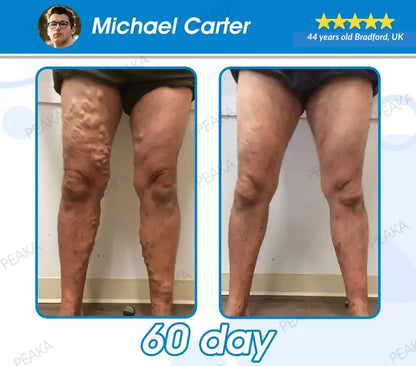 [𝐎𝐟𝐟𝐢𝐜𝐢𝐚𝐥 𝐔𝐊 𝐒𝐭𝐨𝐫𝐞] 𝐏𝐄𝐀𝐊𝐀® 𝐆𝐋𝐏-𝟏 𝐔𝐥𝐭𝐫𝐚 𝐂𝐨𝐧𝐜𝐞𝐧𝐭𝐫𝐚𝐭𝐞𝐝 𝐋𝐢𝐪𝐮𝐢𝐝 𝐏𝐞𝐚𝐫𝐥𝐬 – 𝐅𝐞𝐚𝐭𝐮𝐫𝐢𝐧𝐠 𝐍𝐀𝐃+, 𝐌𝐨𝐫𝐢𝐧𝐠𝐚, 𝐀𝐂𝐕 & 𝐊𝐞𝐭𝐨 𝐁𝐇𝐁( ✅ 𝐂𝐥𝐢𝐧𝐢𝐜𝐚𝐥𝐥𝐲 𝐞𝐟𝐟𝐞𝐜𝐭𝐢𝐯𝐞, 𝐚𝐝𝐝𝐫𝐞𝐬𝐬𝐢𝐧𝐠 𝐝𝐢𝐚𝐛𝐞𝐭𝐞𝐬, 𝐨𝐛𝐞𝐬𝐢𝐭𝐲, 𝐚𝐧𝐝 𝐜𝐚𝐫𝐝𝐢𝐨𝐯𝐚𝐬𝐜𝐮𝐥𝐚𝐫 𝐜𝐨𝐧𝐜𝐞𝐫𝐧𝐬 𝐟𝐨𝐫 𝐥𝐨𝐧𝐠-𝐭𝐞𝐫𝐦 𝐡𝐞𝐚𝐥𝐭𝐡 𝐛𝐞𝐧𝐞𝐟𝐢𝐭𝐬)